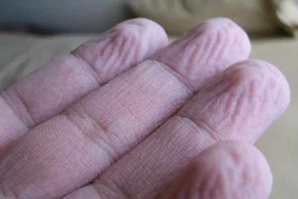لماذا تتجعد أصابع اليدين والقدمين بنفس النمط في الماء؟