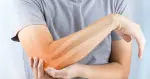 أعراض نقص الكالسيوم الشديد في العضلات والأعصاب